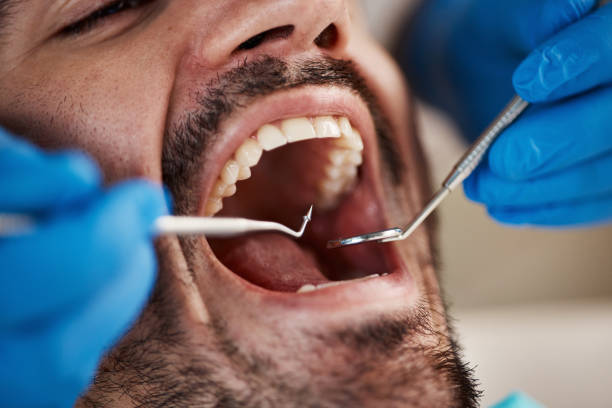 Best Emergency Broken Tooth Repair in Drumright, OK